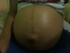 Annita